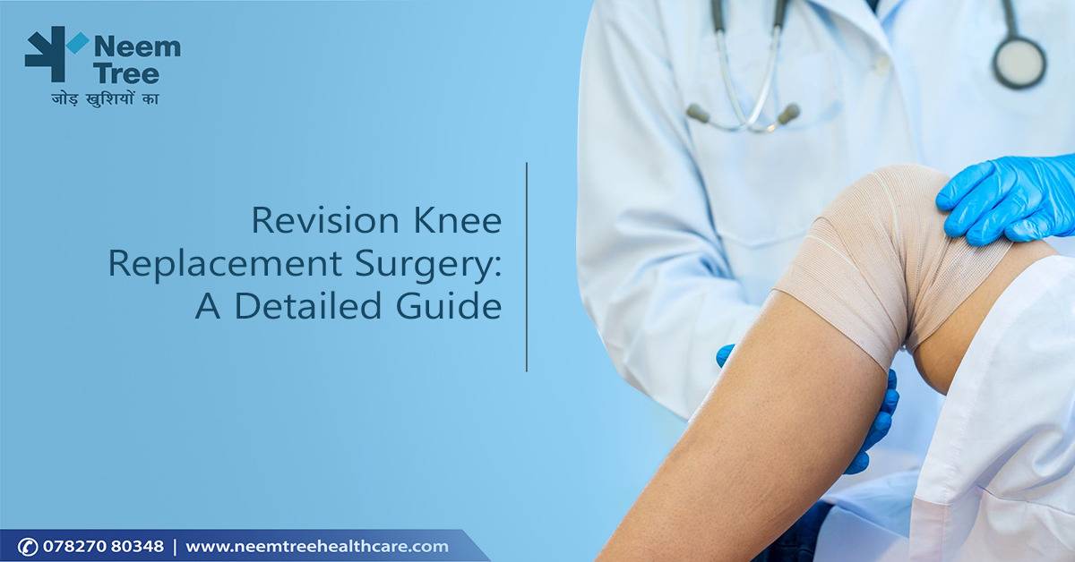 Revision Knee Replacement Surgery- A Detailed Guide